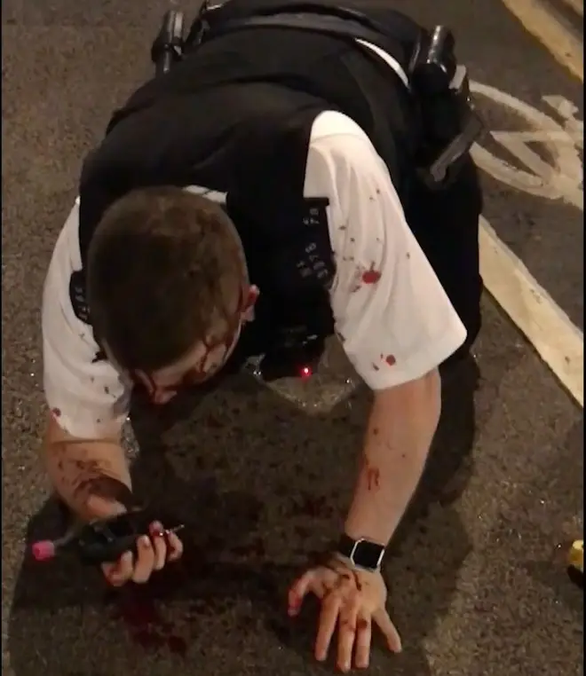 A bloodied Pc Outten on the floor after he was attacked