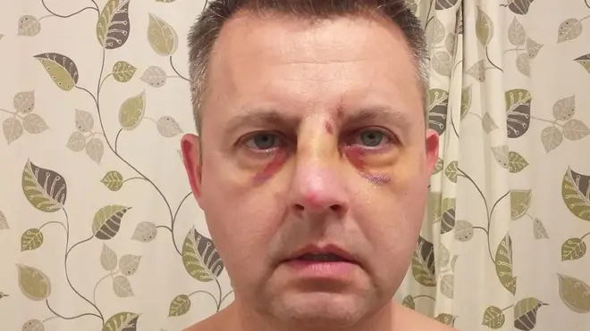 Pc Darren Jenkins, 47, was left with a broken nose after he was attacked