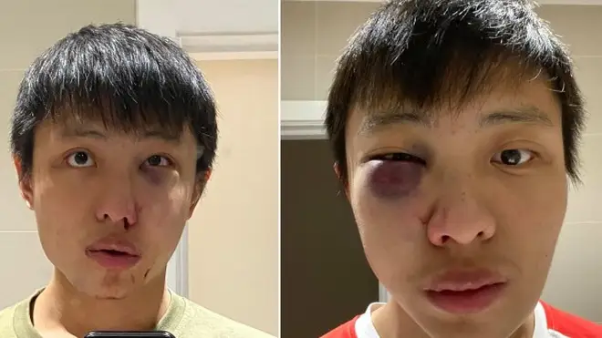 Jonathan Mok was attacked in central London