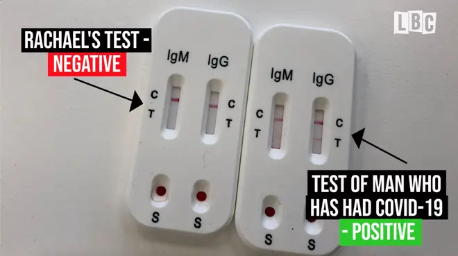 How the antibody test results look