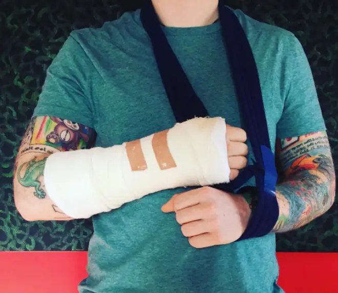 Ed Sheeran posted a picture of his cast on Instagram