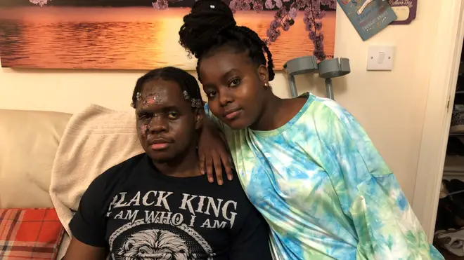 The victim of hit-and-run attack- who only wants to be referred to as K or Kdogg, the name he uses when he performs music, recovering at home with his sister