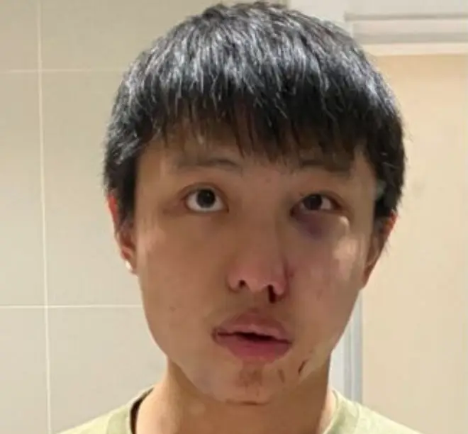 Jonathan Mok posted images of his injuries to Facebook