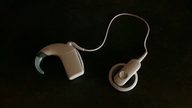 A cochlear implant
