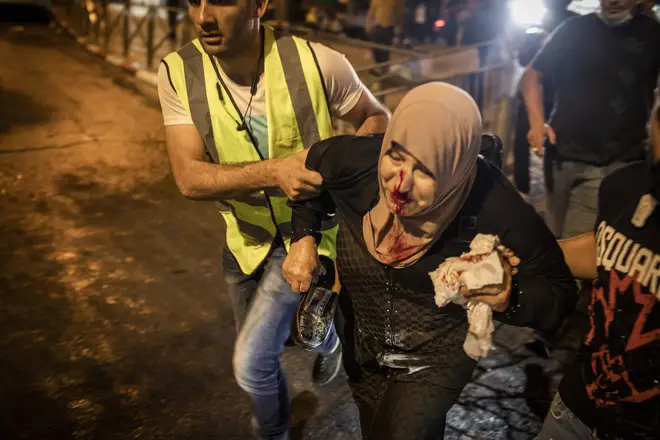 An injured woman is helped during a demonstration against the planned eviction process for the Palestinians in the Sheikh Jarrah neighbourhood.
