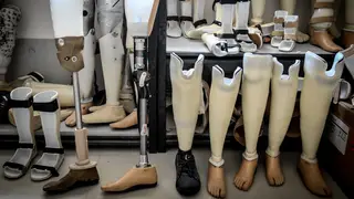 Prosthetic legs (file photo)