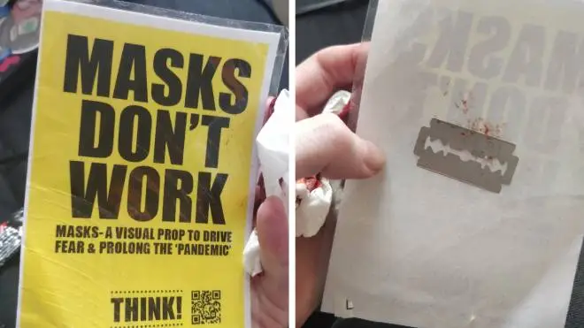 The Cardiff woman had her hand cut by a razor blade stuck to the back of an anti-mask poster