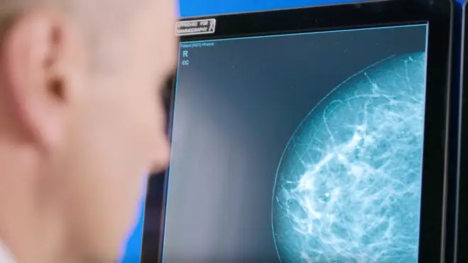 Radiologist look at mammogram screen