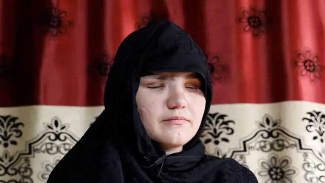 Khatera had her eyes gouged out by the Taliban in a brutal attack last year