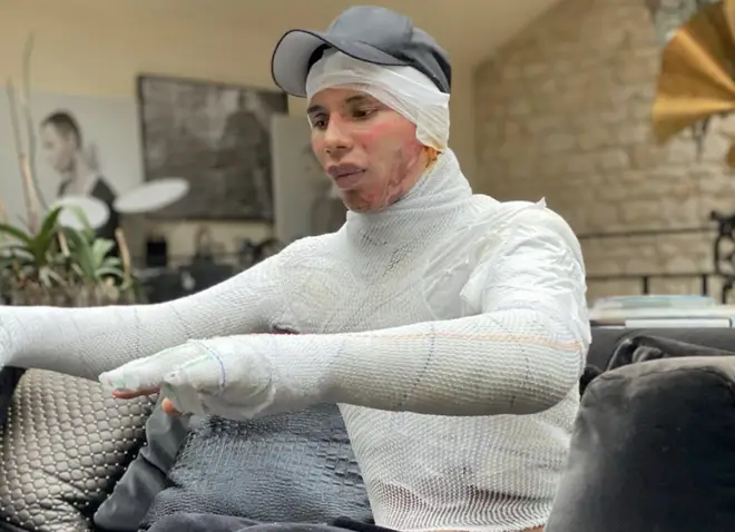 Olivier Rousteing shared pictures of himself wrapped in bandages