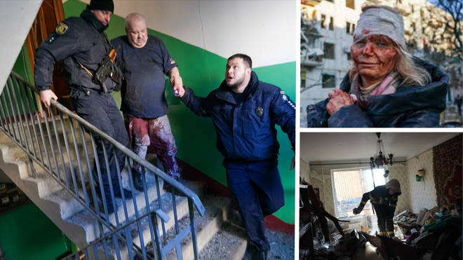 Images lay the cost of Putin's invasion on ordinary people