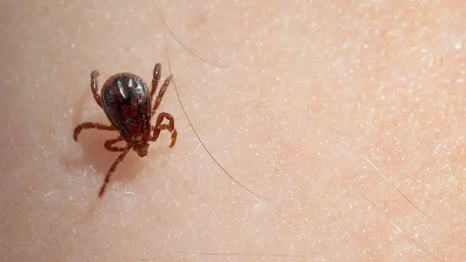 People are being advised to use tick repellents where appropriate after a case of the virus was found