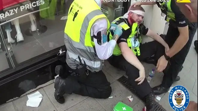 Injuries to PC James Willetts as captured on body worn video