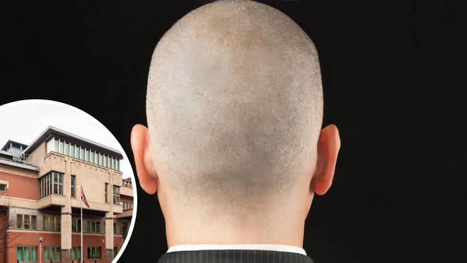 A tribunal in Sheffield has found it can be sex harassment to comment on a man's baldness
