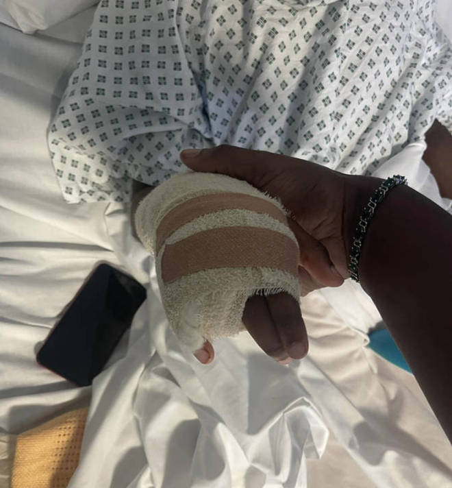 Raheem made a desperate attempt to leave the school grounds but got his right-hand ring finger caught while climbing a fence, causing a severe injury.