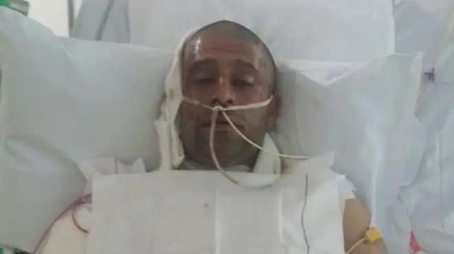 Jameel Mukhtar in hospital following the horrendous attack, which left him with severe burns over his face and body Photo: Gofundme