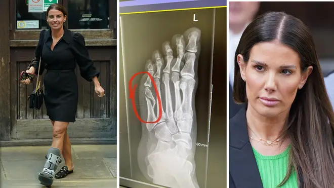 Coleen Rooney hits back at claims she was 'milking' foot injury