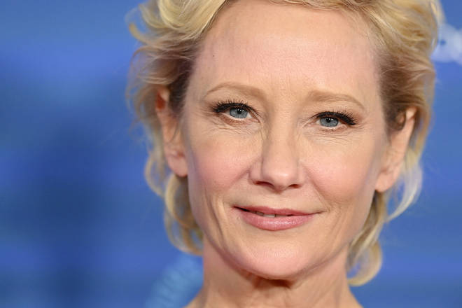 Anne Heche was in a critical condition