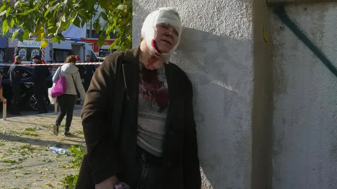 A woman injured in Russian shelling