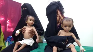 Malnourished children