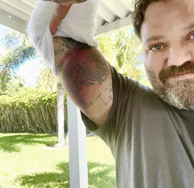 Jackass star Bam Margera 'fighting pneumonia and on ventilator after  positive covid test... - LBC