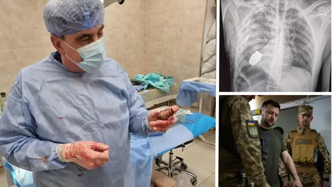The Ukrainian surgeon removed the live grenade from the soldier's chest