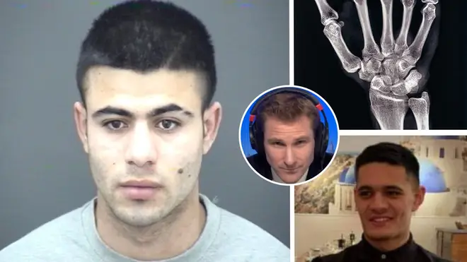 Chris Philp wants to scan asylum seekers' wrists after Abdulrahimzai managed to get into the UK posing as a 14-year-old