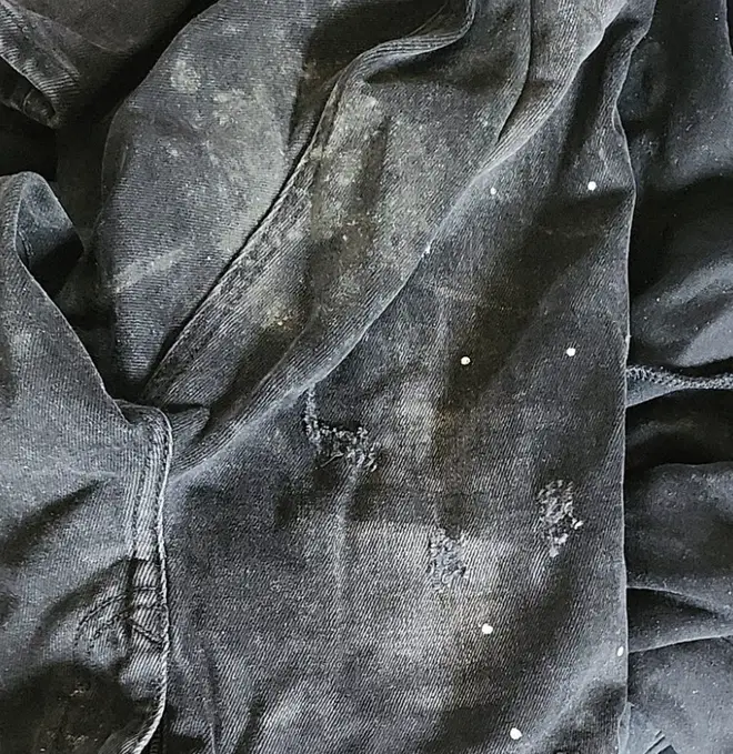 Mould has grown on her son's clothes
