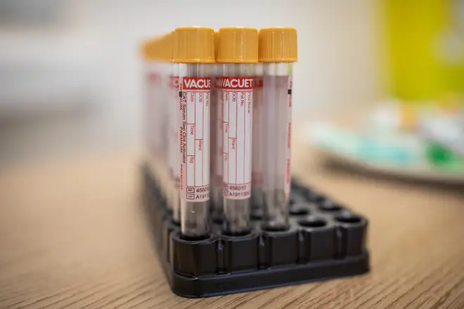 The test does not detect all cancers, but could still be beneficial to detecting the early signals of some in a patient's blood.
