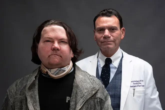 Joe DiMeo and his plastic surgeon Dr. Eduardo Rodriguez pose for a portrait shortly after his transplants