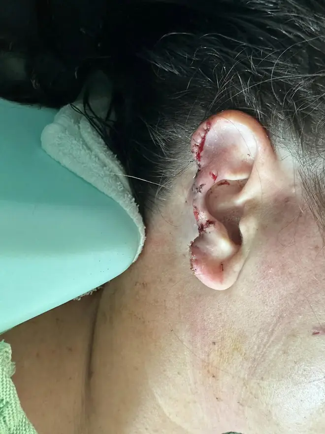 The wild animal clawed at Jen Royce's face and tore chunks from her ear during the attack.