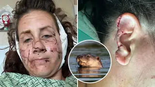 The attack saw Jen Royce clawed extensively by the wild animal, sustaining extensive injuries over what she describes as a "5 minute" attack.