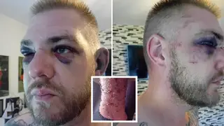 Ben Francis Cźyżyk says he was attacked in Wolverhampton on Friday night
