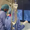 PreSize software being used by surgeons live