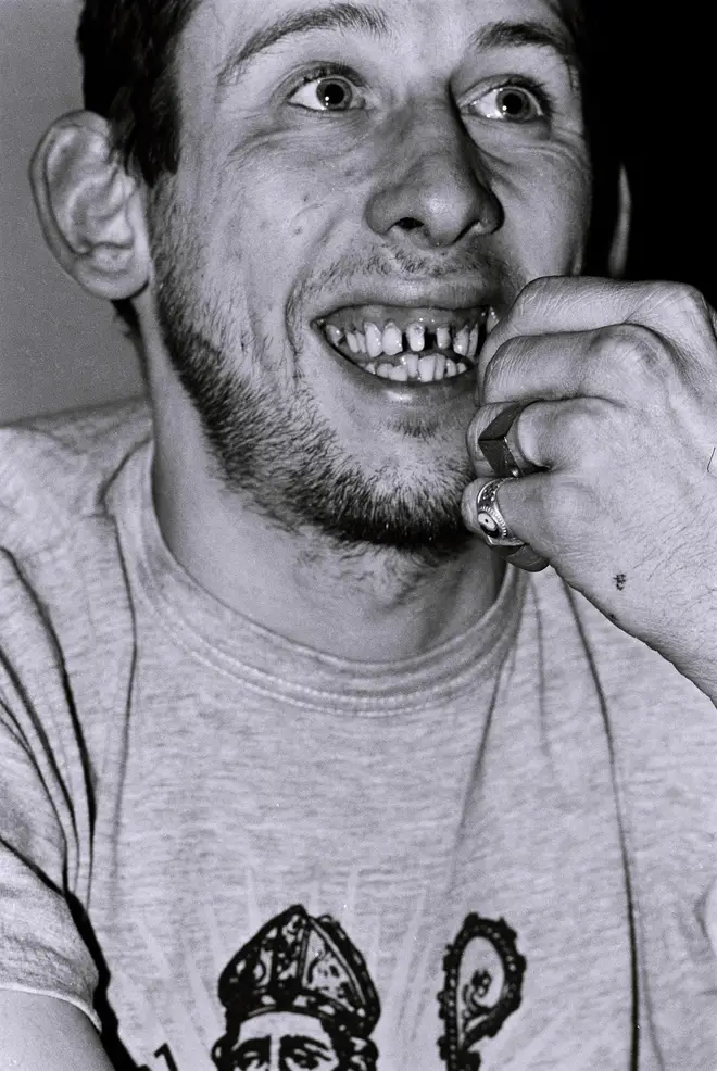 Shane Macgowan of the Pogues just prior to the release of A Fairytale Of New York in 1987