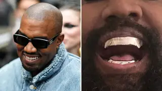 Ye appears to have taken out his teeth
