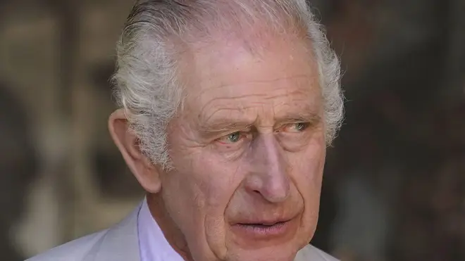 King Charles will attend hospital next week to be treated for an enlarged prostate