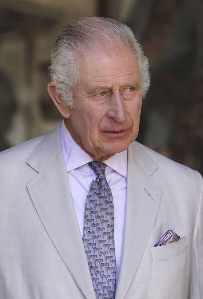King Charles is in hospital for prostate treatment