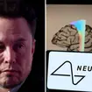 Elon Musk's Neuralink company has cleared a major hurdle