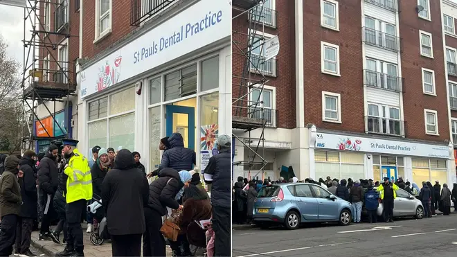 Police intervene as hundreds queue for Bristol NHS dentist