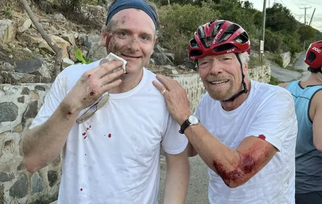 Sir Richard Branson (right) was left bloodied after hitting a pothole on his bike