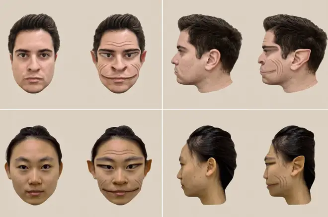 Condiția extrem de rară îi permite doar să vadă versiuni distorsionate ale fețelor umane