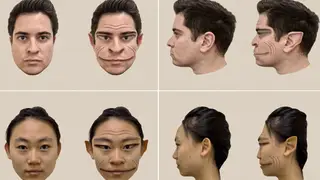 The extremely rare condition only allows him to see distorted versions of human faces