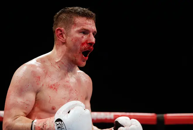 Willie Limond during the British Super-Lightweight Championship bout against Tyrone Nurse at the SSE Hydro, Glasgow.