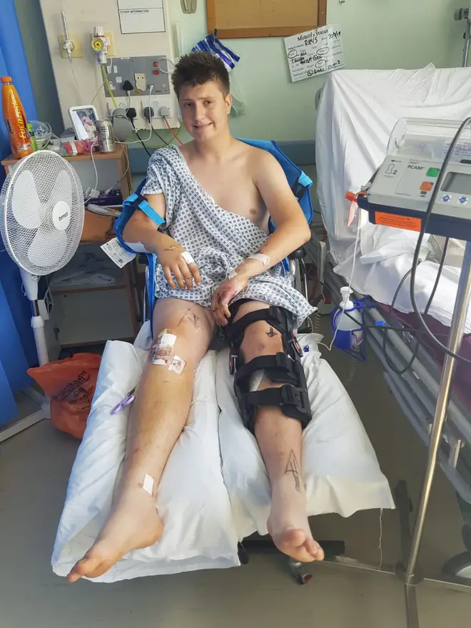Rhys Hunt was injured in the Stevenage car cruise crash