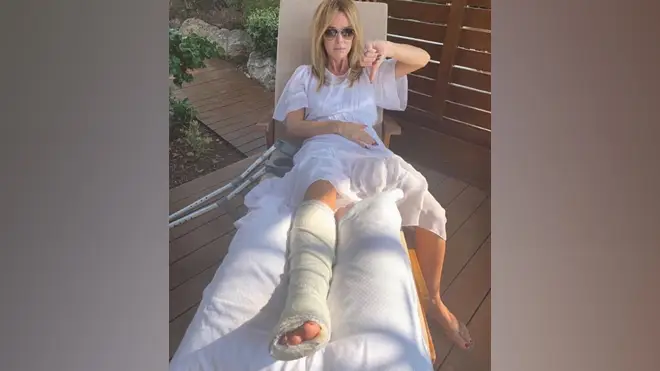 Amanda Holden recovers after suffering a broken leg