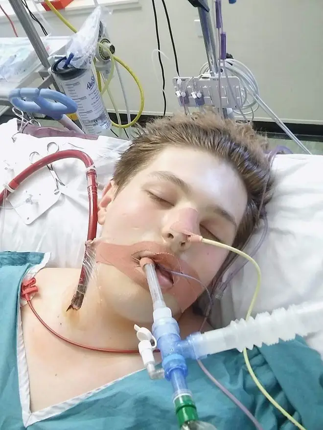Ewan was attached to an ECMO machine to keep him alive