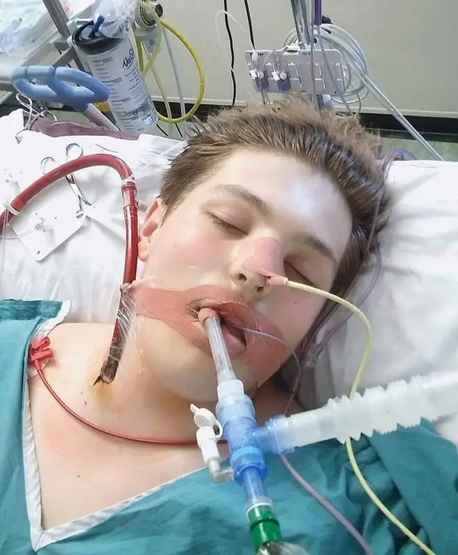 Ewan was attached to an ECMO machine to keep him alive